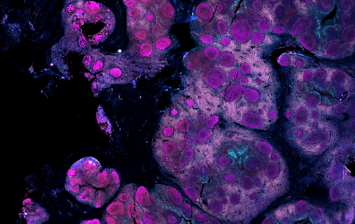 Cell Therapy &amp; Regenerative Medicine