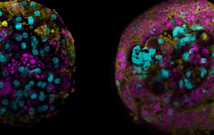 Drug Discovery