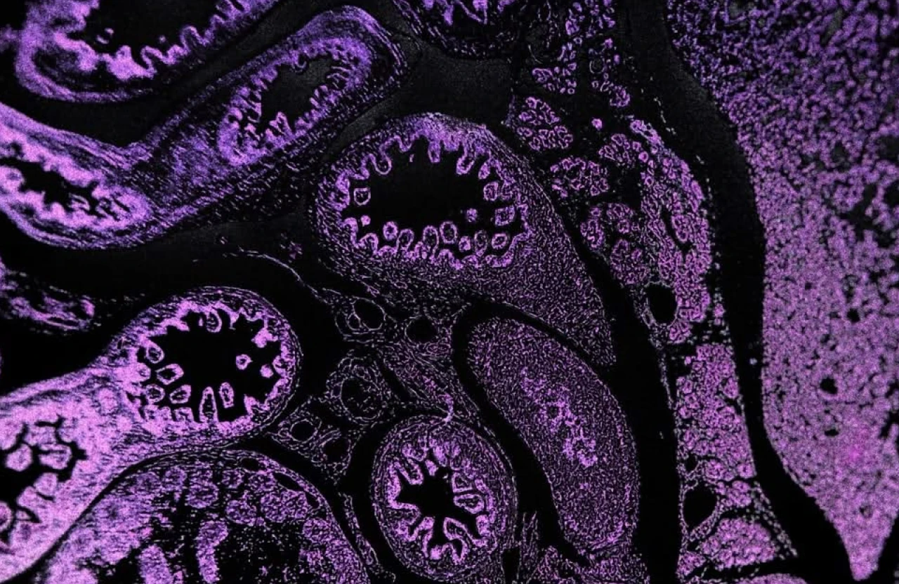 AI-Driven Discovery of Skin Anti-Aging Targets