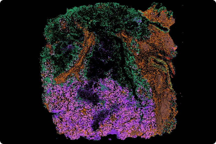 Spatial Transcriptomics Data from Clinical Tumor Samples