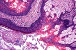 CAR-T Engineering and Functional Optimization